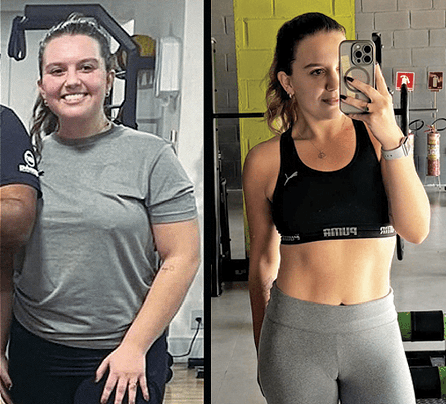 O antes e depois da Dra. Laís Branco, que decidiu mudar seus hábitos alimentares e sua rotina de atividade física, com acompanhamento de nutricionista, nutróloga e do personal studio