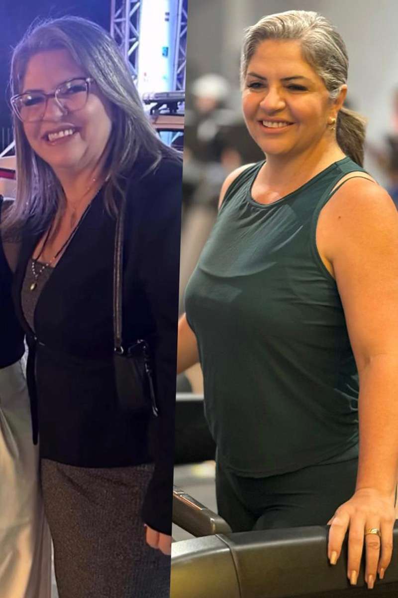 Antes e depois de Deila Estrella. (Arquivo)